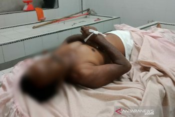 Pria ini ditemukam tewas dalam kondisi tidak berbusana di sebuah hotel