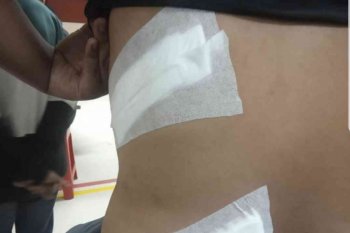 Satu tewas, tawuran antarpelajar di Bekasi