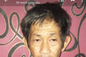 Hanya karena tidak mau disuruh tidur, pria ini tampar mata anaknya hingga memar dan lebam