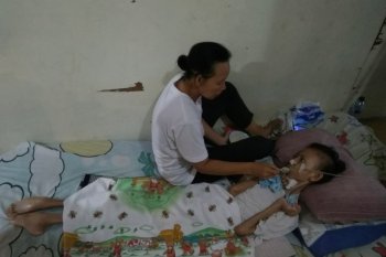 Anak buruh cuci alami pengeriputan otak butuh bantuan