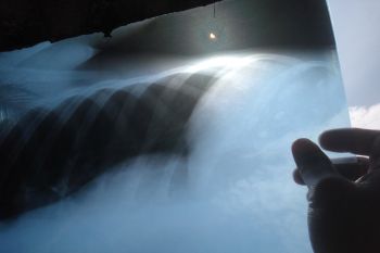 Gerhana matahari cincin disaksikan pula warga di Lampung Timur