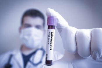 Jerman perkirakan vaksin corona dapat dikembangkan dalam beberapa bulan