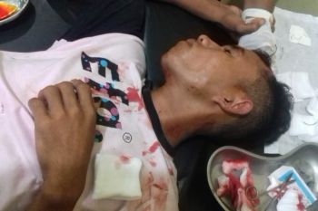 Dua desa di Dompu tawuran, dua warga luka robek di kepala