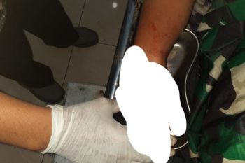 Saling bacok, dua warga masih bersaudara di Dompu alami luka serius