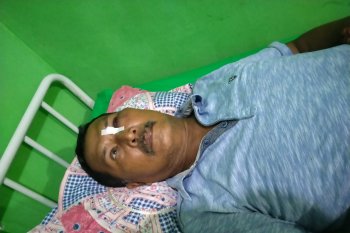 Usai sosialisasi bahaya Corona, kepala kampung ini dianiaya hingga luka lebam