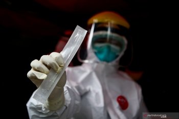 Laboratorium Rapid Test COVID-19 RSPAD Gatot Subroto siap beroperasi