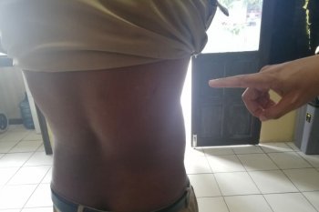 Sekretaris Desa luka-luka dikeroyok warga yang kecewa tidak kebagian bantuan COVID-19