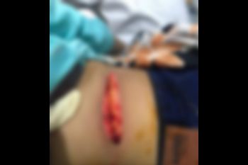 Didasari rasa cemburu dan tak terima diminta cerai, seorang pria bacok istri hingga luka parah