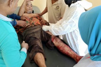 Warga Desa Sepahat Bengkalis diterkam harimau saat menoreh getah