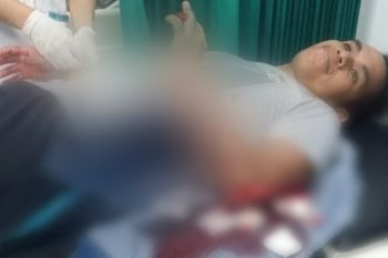 Karena cekcok mulut, 3 pria di Dompu saling bacok ketiganya luka parah