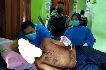 Tangan kiri nyaris putus saat kepergok curi celana dalam mantan istri