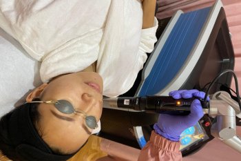Tren perawatan kulit dengan teknologi pikosekon