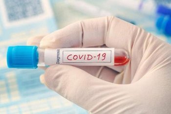 Seorang bayi baru lahir di Probolinggo terkonfirmasi positif COVID-19