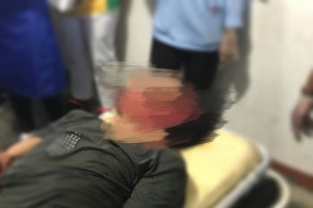 Pembunuhan oleh orang tak dikenal di Yahukimo kembali terjadi