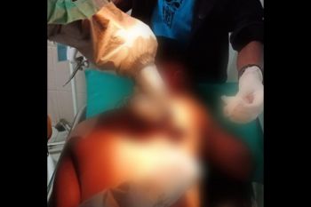 Dua pelajar dibacok dan dipanah oleh orang tak dikenal