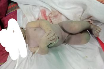 Masya Allah! jasad bayi Laki-laki yang ditemukan di Sumbawa Barat seperti orang sedang salat