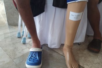Ini penyebab bantuan bagi disabilitas kurang maksimal