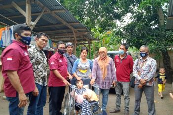 Gubernur NTB bantu bocah penderita hidrosefalus di Lombok Utara