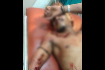 Niat lerai penganiayaan di pasar, pria di Dompu ini malah kena bacok