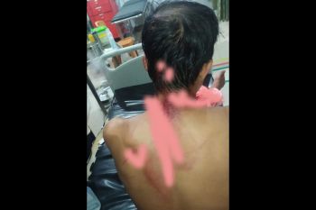 10 masuk puskesmas, satu keluarga berkelahi gegara sengketa lahan di Lombok Tengah