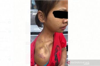 Polisi Malaysia menangkap dua orang penyiksa PRT WNI