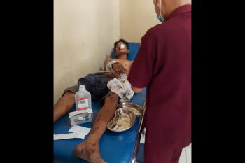 Jambret handphone anak kecil, pemuda asal Desa Beleka Lombok Tengah babak belur dihajar warga