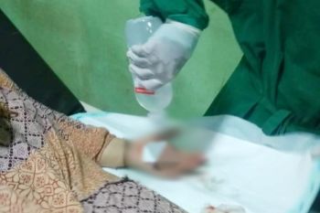 Seorang perampok di Sampit ditangkap setelah sempat melukai korbannya