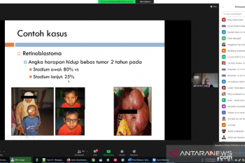 Keterlambatan diagnostik kendala dalam penanganan kanker pada anak