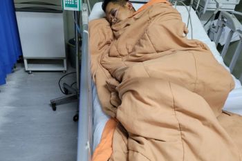 Eks Jaksa KPK kecelakaan saat berolahraga pagi, dirawat di ruang ICU