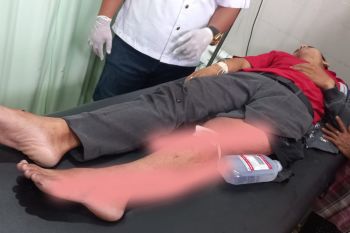 Kecelakaan di Mantang Lombok Tengah, dua pengendara motor patah tulang