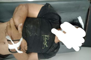 Sepeda motor "adu jangkrik" di Mantang Loteng, dua meninggal