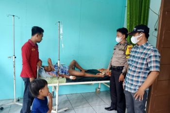 Bocah 11 tahun sebagian tubuhnya melepuh akibat bermain petasan