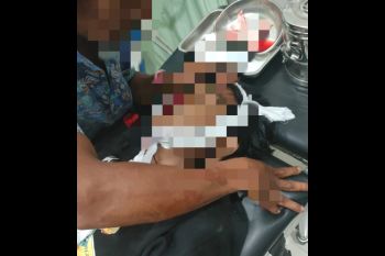 Miris, remaja 15 tahun meninggal akibat kecelakaan di jalan raya Batukliang