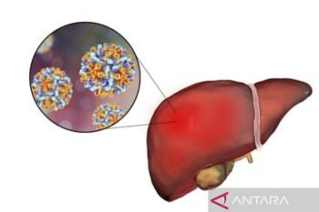 Kasus hepatitis akut di Jakarta perlu bukti laboratorium