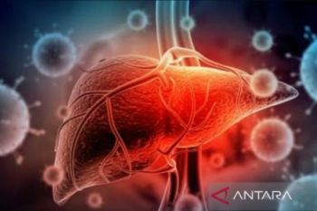 Dokter temukan gejala awal hepatitis nyeri perut hingga diare