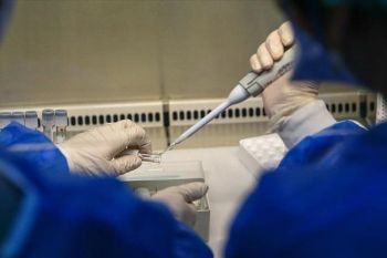 Uni Emirat Arab konfirmasi tiga kasus baru cacar monyet