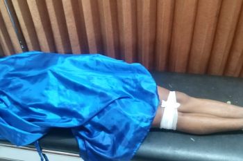 Satu tewas, sepeda motor kecelakaan di tikungan jalan Batukliang Lombok Tengah