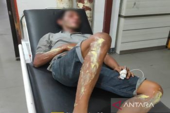 Kaki hingga wajah seorang warga Palangka Raya terbakar saat memindahkan BBM