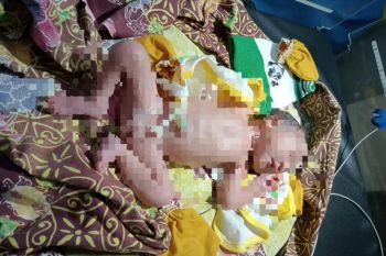Warga Desa Jelantik Lombok Tengah dihebohkan penemuan bayi masih hidup