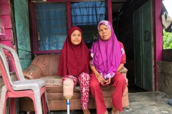 Impian 7 tahun Susmayeni memiliki kaki palsu