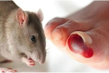 Dinkes Tanggamus ingatkan warga waspadai penyakit leptospirosis