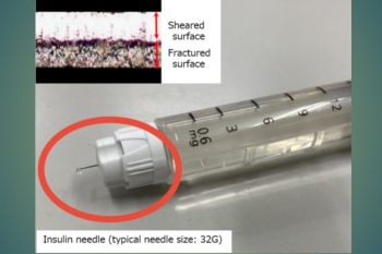 Start of Sales of Stainless Steel Materials for Injection Needles to Europe and China Compliant with the European Medical Device Regulations Cobalt Composition Regulations