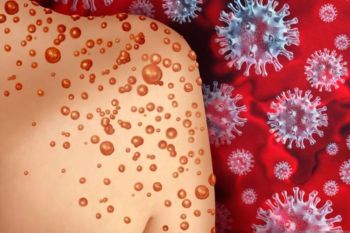 Jakarta administers second dose of monkeypox vaccine