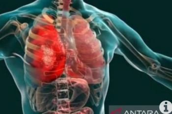 Misinformasi! bakteri Mycoplasma Pneumoniae sama seperti COVID-19