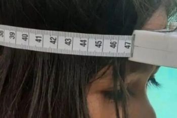 Prevalensi stunting di Manggarai Barat turun