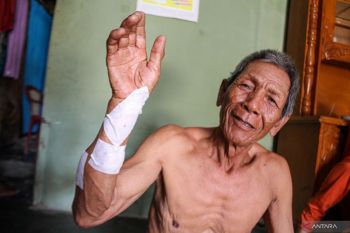 Terluka, Seorang pria di Lampung Selatan diserang Buaya