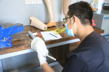 RSUD Kota Tangerang sediakan layanan alat bantu kaki bengkok