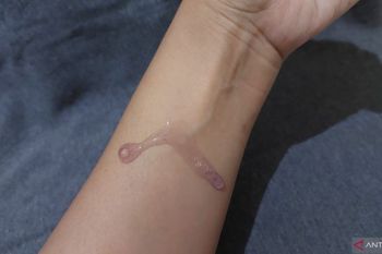 Dermatolog jelaskan mengapa eksfoliasi kulit tak boleh berlebihan