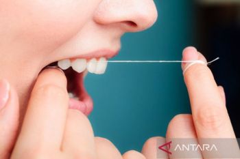 Kemarin, rasa ngilu pada gigi hingga harga Jetour Dashing