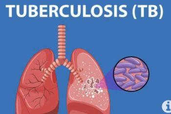 Dinkes Lampung Selatan intensifkan skrining untuk eliminasi TBC 2030